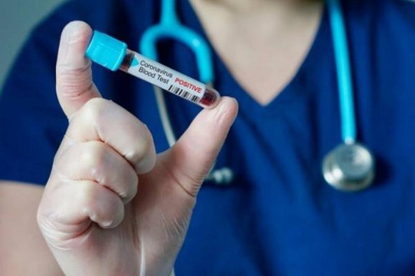 Песец и Зе: Украина заняла место ниже Вьетнама по тестированию COVID-19