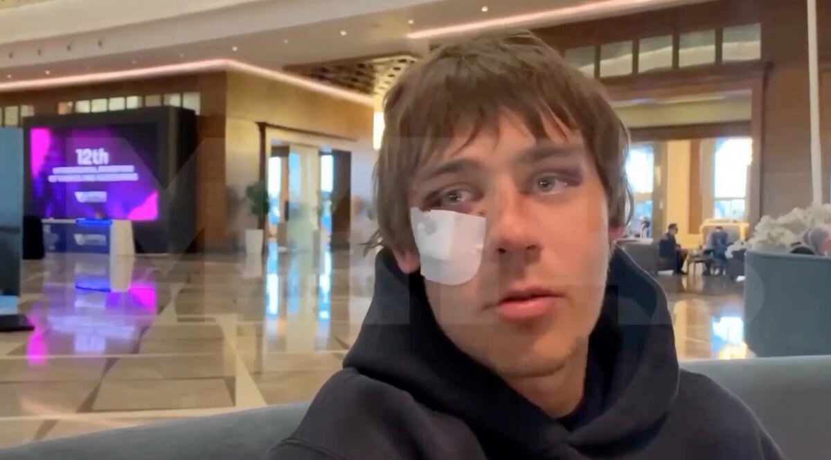 «Услышал, как кто-то кричит «Слава Украине»»: Российский футболист с подбитым глазом рассказал о драке с игроками «Миная»